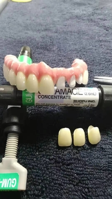Corona dentaria smontabile del singolo titanio flessibile per la clinica dentaria