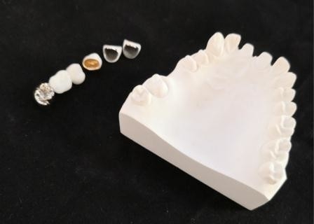 Resistenza della corrosione completa su misura del metallo della corona dentaria della porcellana di PFM