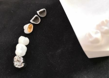 Resistenza della corrosione completa su misura del metallo della corona dentaria della porcellana di PFM