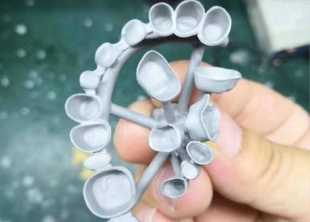 Resistenza della corrosione completa su misura del metallo della corona dentaria della porcellana di PFM