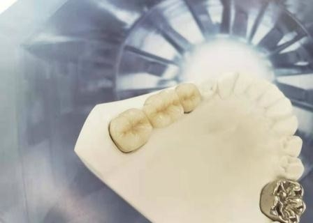 Corona dentaria di lucidatura alto Intermiscibility biologico della porcellana dell'OEM