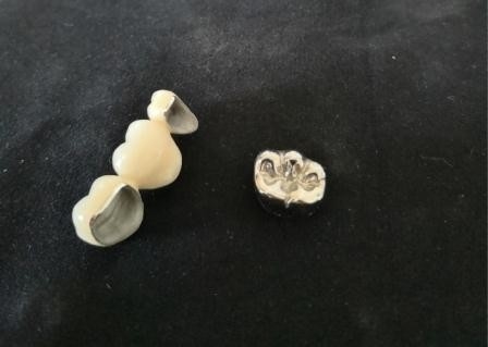 Corona dentaria di lucidatura alto Intermiscibility biologico della porcellana dell'OEM