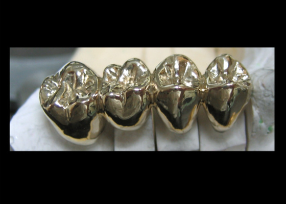 Colata facile dentaria preziosa del ponte PFM della corona degli alti semi di stabilità