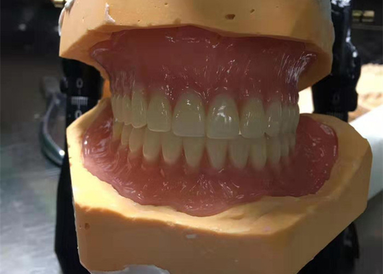CAD-CAM che 3D di gomma ha stampato le corone sono facili da mantenere ed adattarsi