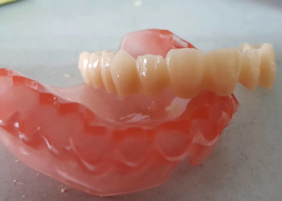 L'OEM realistico 3D di dati di Digital ha stampato i modelli dentari per il dentista Study
