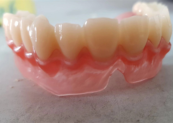 L'OEM realistico 3D di dati di Digital ha stampato i modelli dentari per il dentista Study