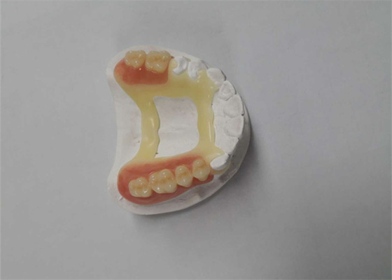 Stampatore dentario di gomma Dental Laboratory della corona 3D di sembrare naturale PFM