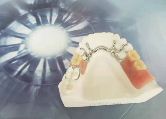 Cocr Chrome ha fuso durezza pulita facile della corona dentaria smontabile la forte