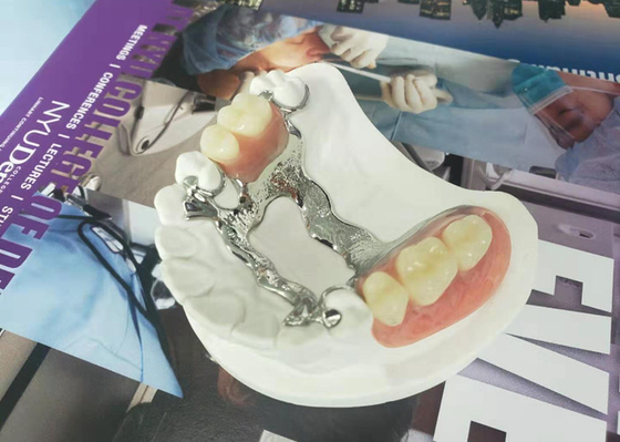 Natrural protegge 3D che stampa la protesi dentaria smontabile fissa per il dentista Study