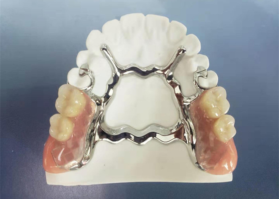 Natrural protegge 3D che stampa la protesi dentaria smontabile fissa per il dentista Study