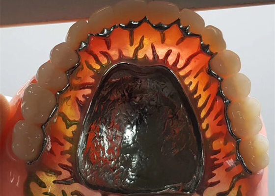 Corona dentaria smontabile dell'OEM di sicurezza ad alta intensità per il dentista Study