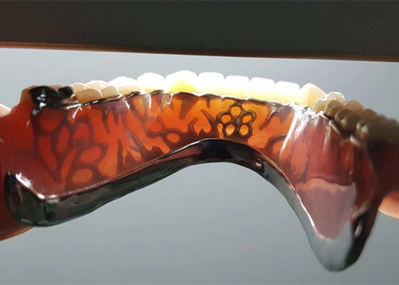 Corona dentaria smontabile dell'OEM di sicurezza ad alta intensità per il dentista Study