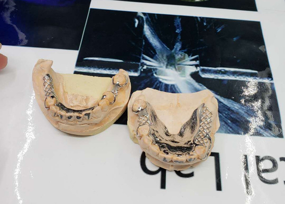 L'alta precisione CAD-CAM ha riparato la progettazione smontabile della digitalizzazione del ponte