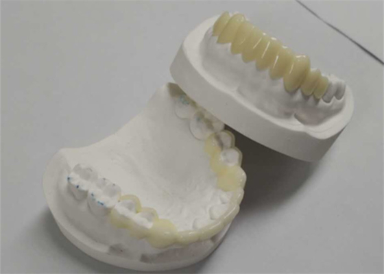 Stampa CAD CAM 3D ad alta durabilità Corone temporanee Resina durevole