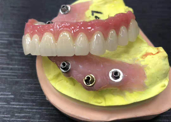 Corona dentaria di biossido di zirconio dell'appoggio dell'impianto naturale interamente su quattro protesi dentarie