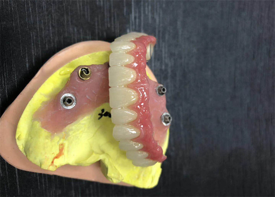 Corona dentaria di biossido di zirconio dell'appoggio dell'impianto naturale interamente su quattro protesi dentarie