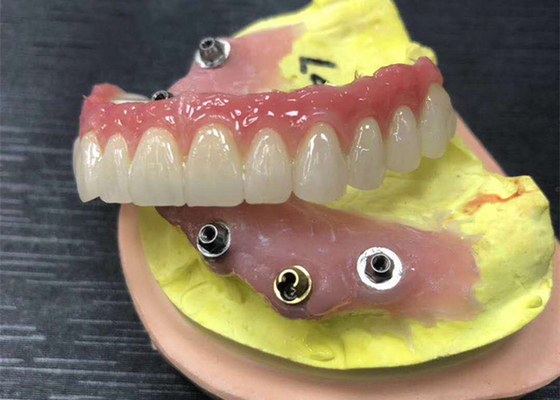 Corona dentaria di biossido di zirconio dell'appoggio dell'impianto naturale interamente su quattro protesi dentarie