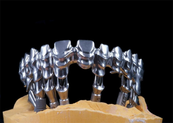 Materiale naturale dell'impianto di FDA dell'appoggio dentario ad alta resistenza della corona