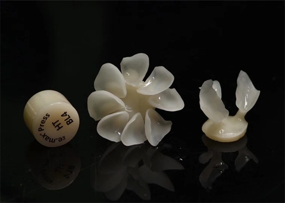 Le impiallacciature composite dentarie di Durablity CAD-CAM altamente hanno dettagliato accurato