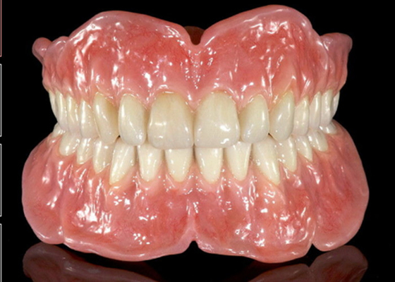 La protesi dentaria parziale della corona dentaria smontabile di gomma flessibile facile mantiene