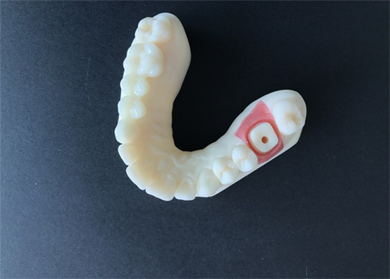 L'alto dente della corona di biossido di zirconio della stabilità PFM macchia resistente per la ricerca