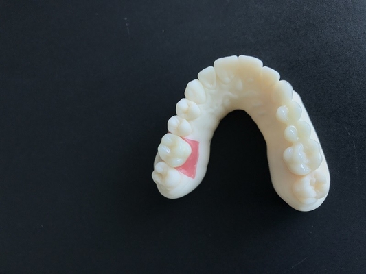 L'alto dente della corona di biossido di zirconio della stabilità PFM macchia resistente per la ricerca