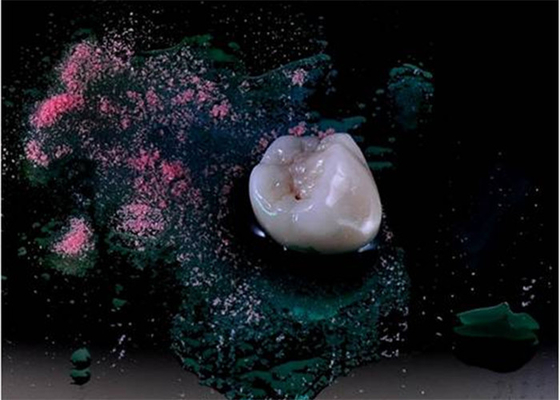 Ultra duro impiallacciare le protesi dentarie Tutto ceramiche dell'impianto di lucidatura della corona dentarie