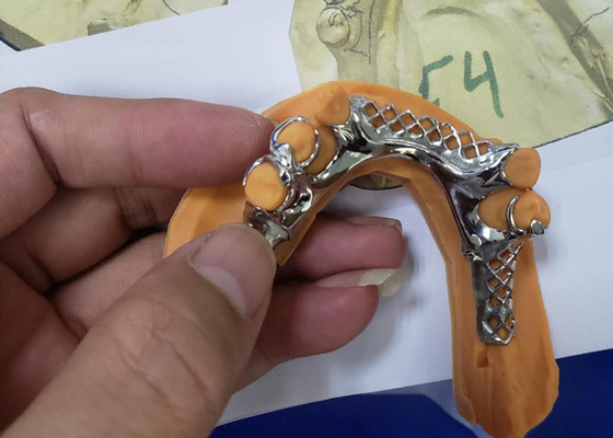 Il ponte dentario flessibile della corona di Digital PFM facile mantiene ultra duro