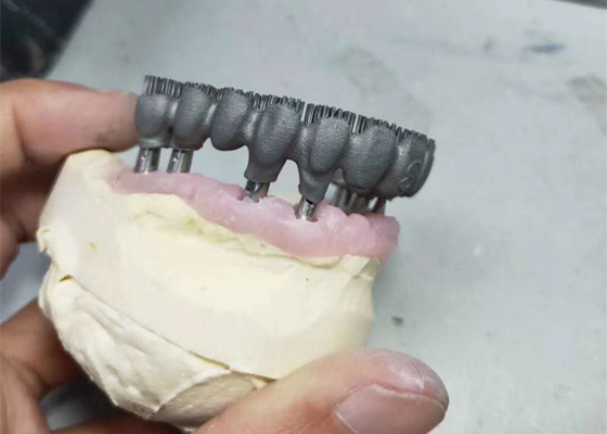 Stampatore durevole Dental Lab Prints di camma PFM 3D di cad per ricerca