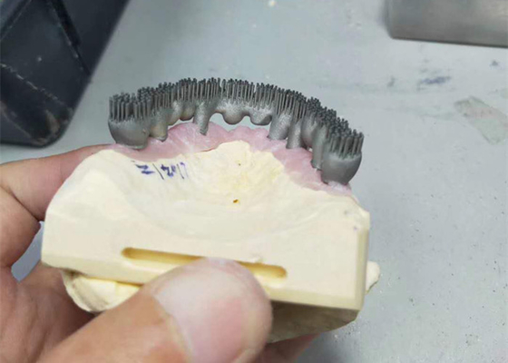 Stampatore durevole Dental Lab Prints di camma PFM 3D di cad per ricerca