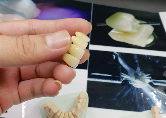 Corona resistente alla corrosione della porcellana dell'OEM di sicurezza tutto lo sguardo naturale ceramico