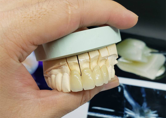 Corona resistente alla corrosione della porcellana dell'OEM di sicurezza tutto lo sguardo naturale ceramico