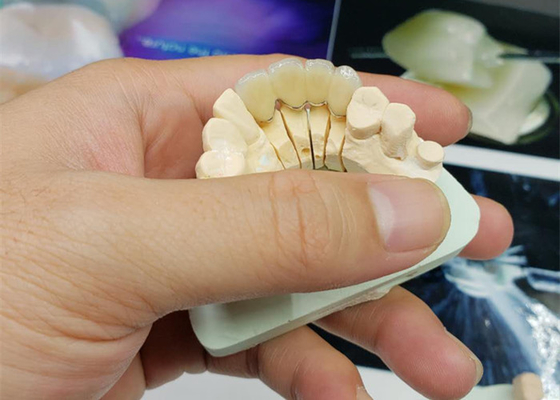 Corona resistente alla corrosione della porcellana dell'OEM di sicurezza tutto lo sguardo naturale ceramico