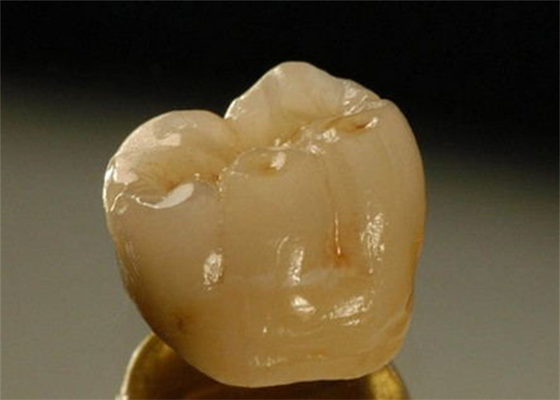 Corona dentaria dell'inter porcellana di miscibilità