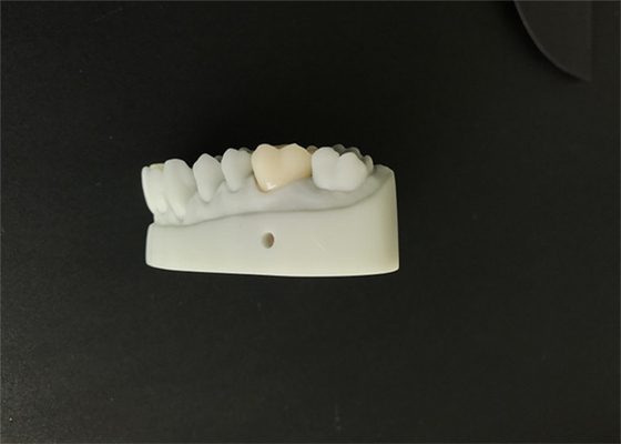 L'OEM 3D ha stampato la progettazione dentaria di camma dei modelli cad per il laboratorio della protesi dentaria