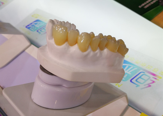 Stampatore dentario Dental Crowns del laboratorio 3D della corona di progettazione PFM di camma di cad