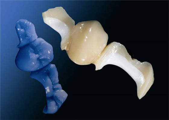OEM su misura che lucida il parte sovrapposto in rilievo dentario Tutto ceramico dell'intarsio dell'impiallacciatura della corona