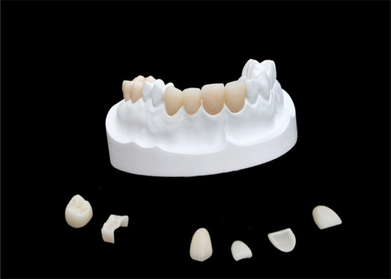 Impiallacciature composite della porcellana di IPS E Max Ceramic Dental Crown Comfortable