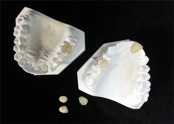 Facile mantenga il parte sovrapposto in rilievo dentario ceramico bianco dell'intarsio dell'impiallacciatura della corona dell'OEM
