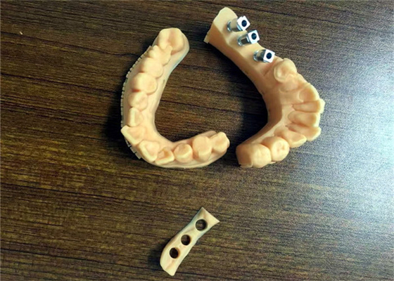 FDA 3D ha stampato la porcellana dentaria della corona dei modelli dentari fusa a metallo