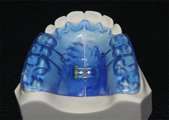 Strumenti dentari ortopedici con alta stabilità e la buona biocompatibilità