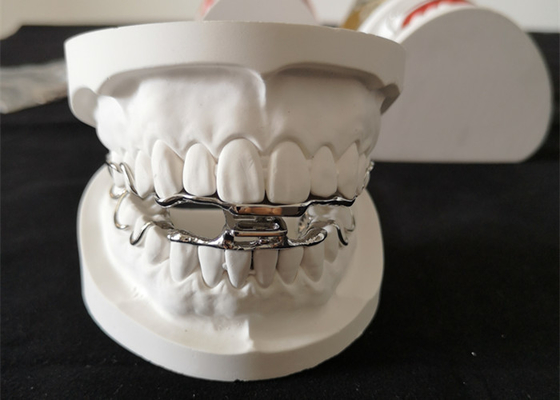 Progettazione ad alta resistenza degli apparecchi ortodontici dentari 3D Digital dell'OEM