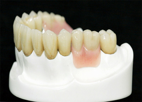 Protesi MK1 di precisione per un'adattazione e una protezione perfette