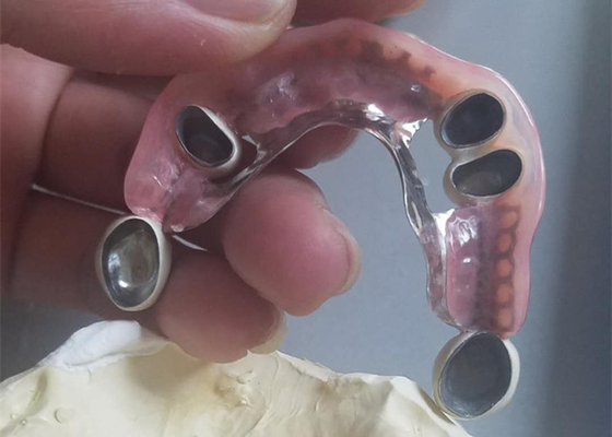 Protesi dentaria durevole flessibile del collegamento di precisione resistente alla corrosione