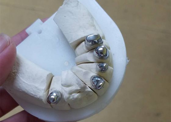 Protesi dentaria durevole flessibile del collegamento di precisione resistente alla corrosione