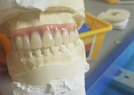 Protesi dentaria durevole flessibile del collegamento di precisione resistente alla corrosione