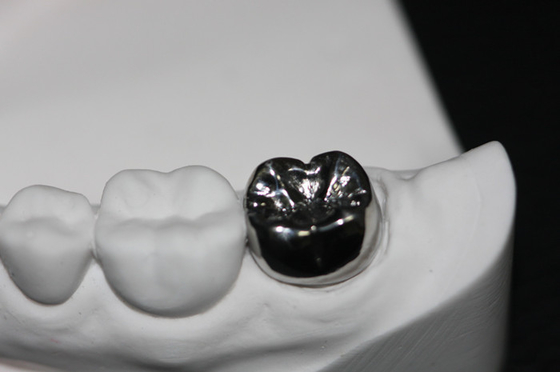 Ponte dentario naturale della corona di FDA di stabilità di colore resistente alla corrosione