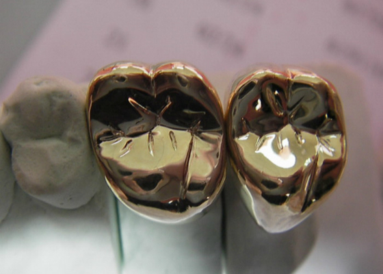 Corona ad alta resistenza del metallo prezioso dei semi del dente della corona del metallo di FMC