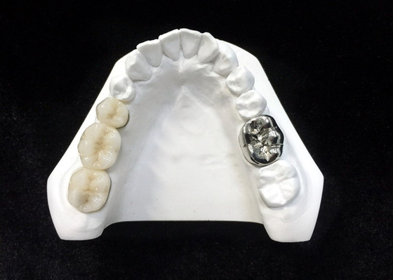 Alta densità dentaria di sicurezza di salute della corona della porcellana ultra dura di Digital