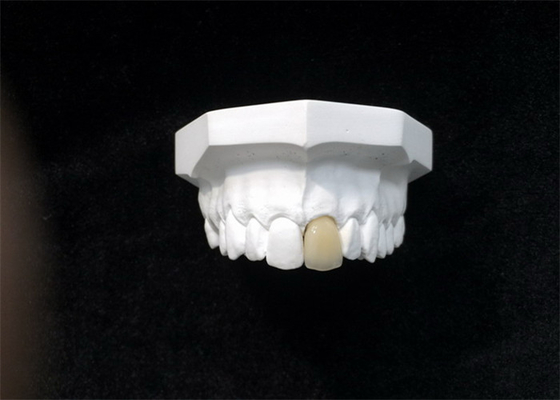 Materiale biologico alta tecnologia della buona di biocompatibilità corona dentaria della porcellana